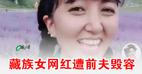 藏族女网红遭前夫毁容
